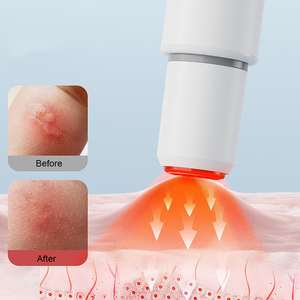 DQ040 nouveau Design Style Simple après l'aide à la morsure dispositif de morsure d'insecte Portable Rechargeable <span class=keywords><strong>et</strong></span> dispositif <span class=keywords><strong>anti</strong></span>-démangeaison physique - Product Image 5