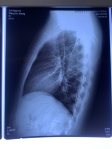 Phim <span class=keywords><strong>Fuji</strong></span> 3500 Máy In Nhiệt 2000 2000 Lite Phim Nhiệt Y Tế Cho CT DR MRI - Product Image 5