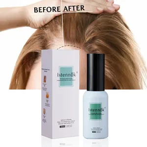 Meest Effectieve Natuurlijke Behandeling Essentiële Haargroei Olie Gezonde Voeding Anti Haarverlies Serum Voor Vrouwen Haarverlies