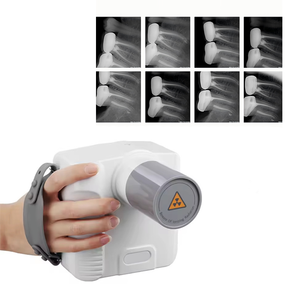 Máquina de Rayos X Dental Portátil, Unidad de Rayos X Veterinaria, Sistema de Imágenes Dentales, Equipo de Radiografía Dental Portátil - Product Image 6