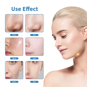 Nouvelle machine hydro-faciale améliorée, machine de nettoyage en profondeur du visage, machine d'hydro-peeling, machine hydro-faciale 10 en 1 - Product Image 5