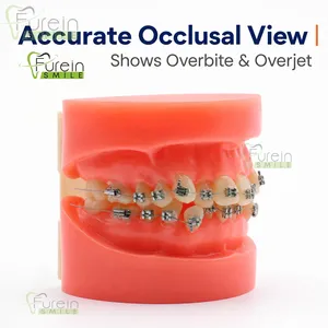 Modelo de Dientes con Maloclusión Ortodóntica, Modelo de Estudio de Desalineación Dental con Bracket y Arco para Entrenamiento de Dentistas y Educación del Paciente - Product Image 3