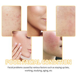 Almohadilla limpiadora de cúrcuma Eelhoe, limpia profundamente la piel, elimina la suciedad, controla el aceite, suaviza el esquí exfoliado y tierno - Product Image 2
