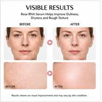 Sérum facial réparateur à base d'ADN de rose OEM 30 ml, essence anti-âge régulatrice génétique micro-encapsulée brevetée