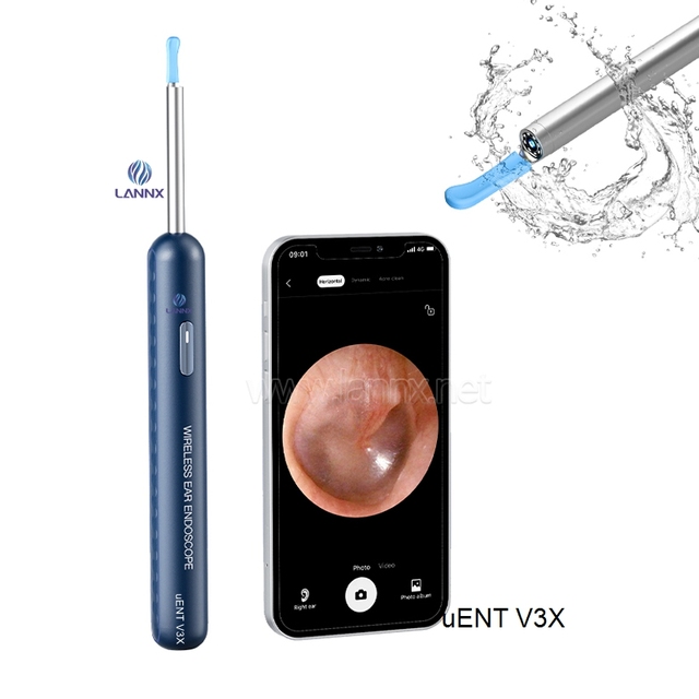 LANNX UENT V3X Fully Stocked Product Wifi Wireless Smart Visual Ear Cleaner With Camera Ear Wax Removal Tool With Otoscope