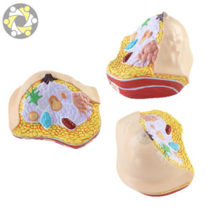 Modèle anatomique du <span class=keywords><strong>cancer</strong></span> du sein féminin dans la section transversale modèle de médecine du sein pathologique - Product Image 5