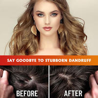 OEM/ODM Grosir 60ml Minyak Esensial Rambut Memperbaiki Rambut Kering dan Mengembang, Menebalkan 100% Minyak Batana Organik untuk Pertumbuhan Rambut