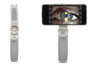Lampe à fente médicale pour ophtalmologie avec fonction numérique - Product Image 3