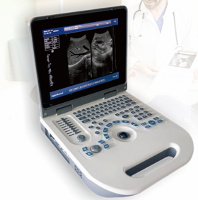 Vente chaude Médical B/W Ultrason <span class=keywords><strong>S50A</strong></span> Ultrason 2D Cahier de Grossesse Gynécologique USG Machine à Ultrasons - Product Image 4