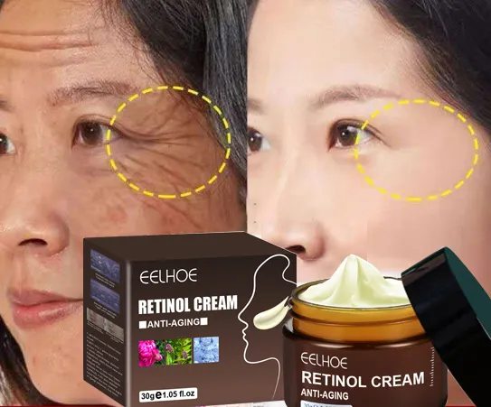RETINOL-crema facial antiarrugas, crema reafirmante para el cuidado de la piel, ácido hialurónico, blanqueamiento hidratante, Cosméticos de belleza
