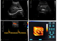 Appareil d'échographie numérique portable 3D avec système d'échographie et accessoires d'échocardiographie - Prix