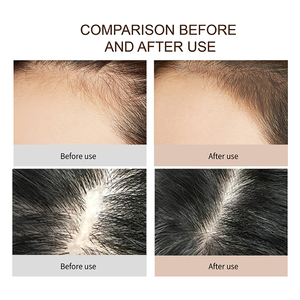 <span class=keywords><strong>El</strong></span> <span class=keywords><strong>mejor</strong></span> champú de hierbas <span class=keywords><strong>para</strong></span> <span class=keywords><strong>el</strong></span> <span class=keywords><strong>cabello</strong></span>, fabricante de champús chinos que aclara <span class=keywords><strong>el</strong></span> jengibre, anticaída y ayuda al crecimiento del <span class=keywords><strong>cabello</strong></span> - Product Image 4