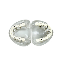 Modelo Anatómico de Implante Dental, 6 Implantes, Mandíbula Superior e Inferior, Restauración de Sobredentadura, Dientes Removibles, Educación, Estudio, Enseñanza