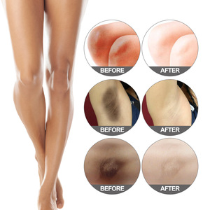 Crème éclaircissante Jaysuing pour les parties intimes, les aisselles et la zone du bikini, pour éliminer les taches sombres. - Product Image 5