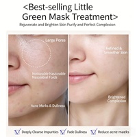 Perawatan Penghalus Pori Terbuka, Kit Pengelupasan Eksfoliasi, Spons Terhidrolisis Spongilla Spicule, Terapi Bio Microneedling, Set Bubuk & Serum