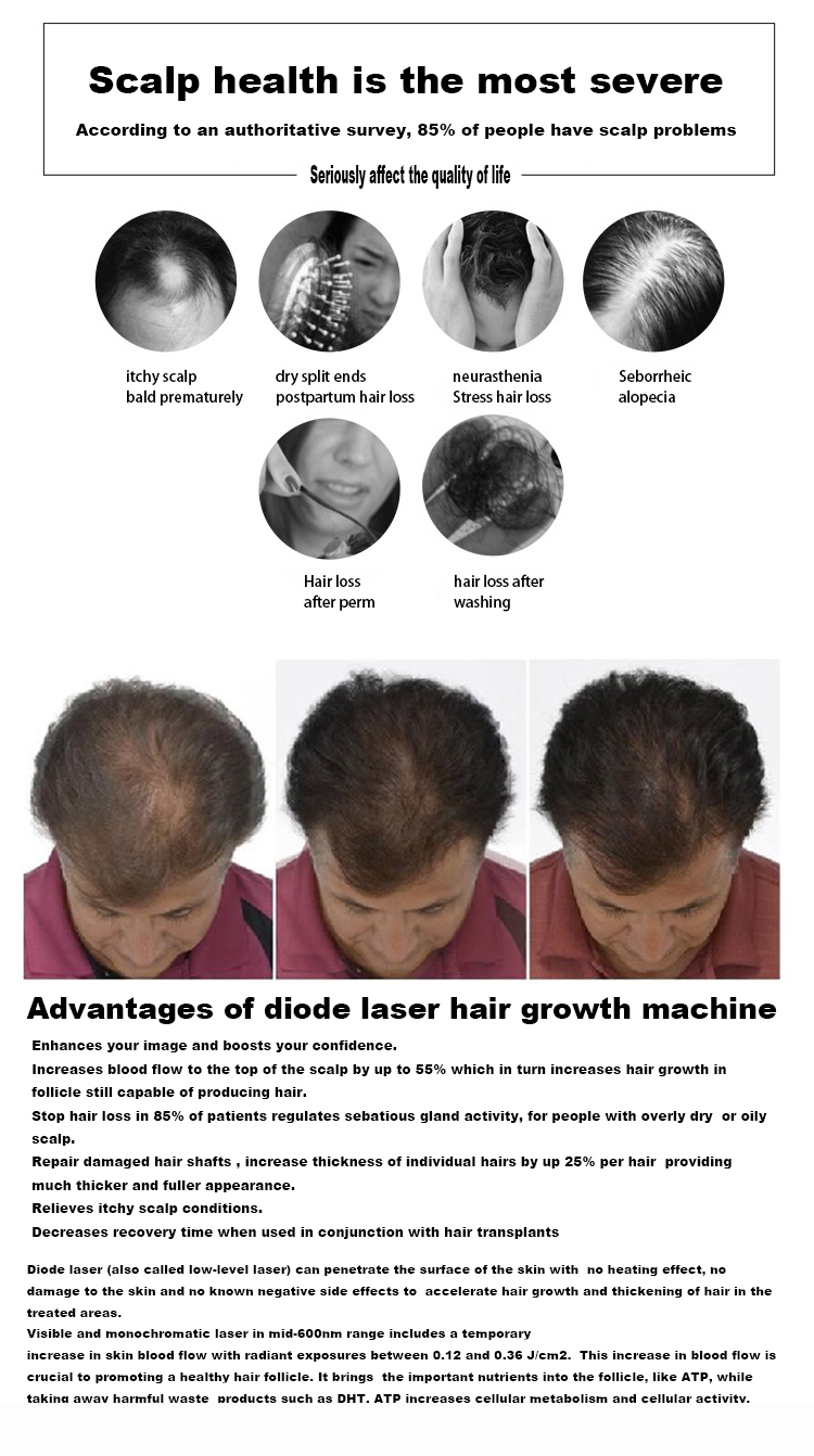 LLLT Laser Anti-Hair Loss Treatment Equipment 650Nm Scalp Massage Led Laser Device For Hair Growth With Hair Follicle Detection