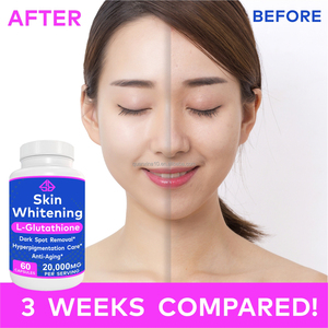 ผิวขาวกระจ่างใส แอล-กลูตาไธโอน 20,000 มก. ต่อหนึ่งหน่วยบริโภค 60 แคปซูล วีแกน ชะลอวัย ลดเลือนจุดด่างดำ - Product Image 4