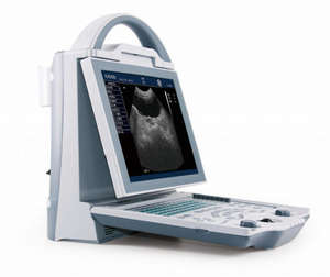 Echografie Scanner Machine ODU-5 Oftalmische Ab Scan Hoge Biometrie Nauwkeurigheid Optica Instrumenten Oogheelkunde Echografie - Product Image 1