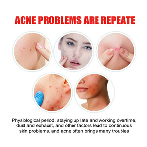 Parche Facial para el Cuidado de la Piel, Limpieza Facial Suave y Equilibrio de la Piel, Anti-Acné, Transpirable y Amigable con la Piel - Product Image 3