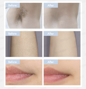 <span class=keywords><strong>Máquina</strong></span> de Depilación Láser de Diodo, Dispositivo de Depilación Facial y Corporal, Eliminador de Vello Facial y Corporal para Hombres y Mujeres - Product Image 3