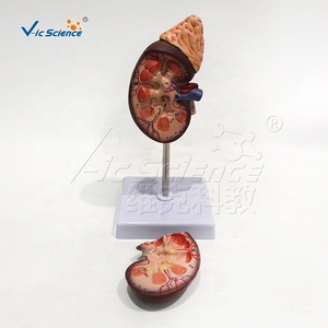 Modelo de Disección Renal de PVC, Tamaño <span class=keywords><strong>Natural</strong></span>, con Calices y Ureter, para Laboratorio de Habilidades de Enfermería, con Certificaciones CE, ISO, ROHS y CNAS - Product Image 2