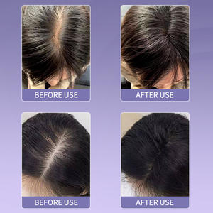 Masseur électrique du cuir chevelu, brosse intelligente à lumière rouge pour la croissance des cheveux, brosse de massage du cuir chevelu pour les cheveux avec distributeur d'huile - Product Image 2