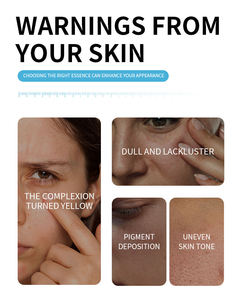 Suero Facial Personalizado con Niacinamida al 10% B3, Esencia Blanqueadora Antienvejecimiento - Product Image 3