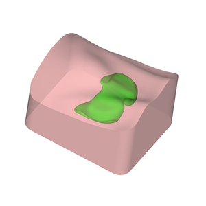 Modulo di Addestramento per Puntura Guidata ad Ultrasuoni della Tiroide, con Lesioni Bilaterali, Dimensioni Reali della Tiroide, Pratica di Biopsia nella Regione del Collo, Modello Fantoccio - Product Image 5