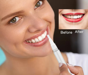 Stylo Gel Blanchissant pour les Dents à la Menthe, Multicolore, OEM ODM, Marque Privée, Blanchiment Dentaire - Product Image 3