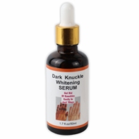 Sérum Liquide Éclaircissant Rapide OEM pour Taches Sombres, Correcteur de Pigmentation pour Peau Noire, Éliminateur Intense pour Jointures des Mains, Coudes et Genoux