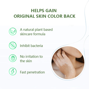 Crème hydratante Vitiligo : Réduit les <span class=keywords><strong>taches</strong></span> <span class=keywords><strong>blanches</strong></span>, répare <span class=keywords><strong>la</strong></span> <span class=keywords><strong>maladie</strong></span>, soin des plaques <span class=keywords><strong>blanches</strong></span>, pommade 20G - Product Image 5