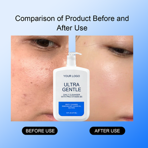 <span class=keywords><strong>Limpiador</strong></span> <span class=keywords><strong>Facial</strong></span> en Gel Suave de Uso Diario Personalizado de Fábrica <span class=keywords><strong>con</strong></span> Glicerina y Pro-Vitamina B5 para <span class=keywords><strong>Piel</strong></span> <span class=keywords><strong>Sensible</strong></span> Propensa al Acné, Hipoalergénico - Product Image 2