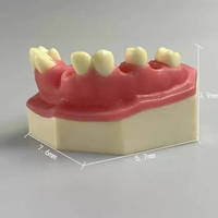 Modelo Maxilar de Práctica de Implantes Dentales KyrenMed con Seno