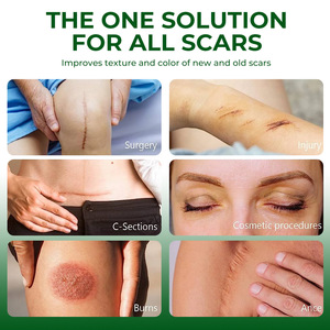 Bálsamo Herbal para el Cuidado de Quemaduras y Heridas por Escaldaduras, Crema Reparadora de Piel Antiinfecciosa y Calmante - Product Image 4