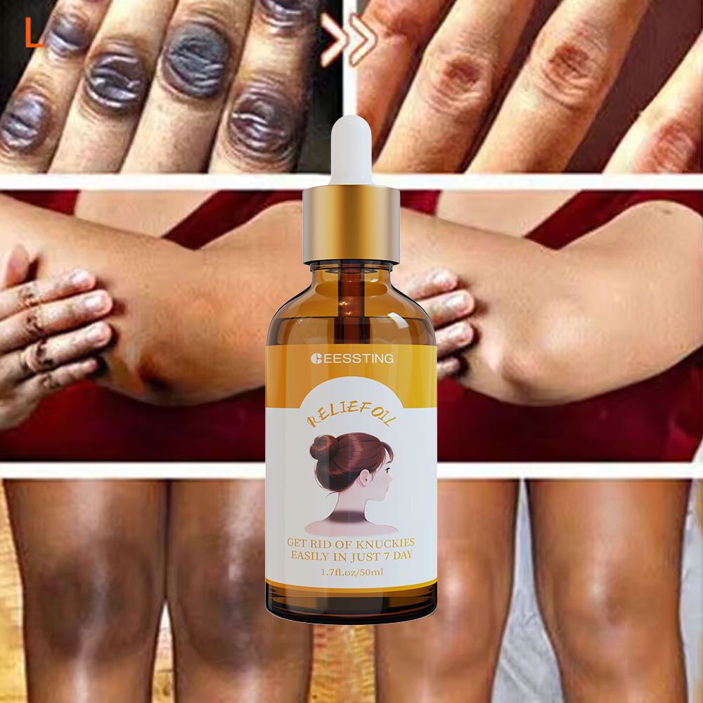 aobenz anti spot serum