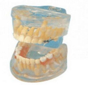 Modèle de mannequin transparent ADA L1009 pour l'évolution des dents de lait chez l'enfant, affichant la morphologie et la structure des dents maxillaires et mandibulaires laiteuses - Product Image 1