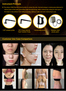 Appareil de thérapie professionnel 3-en-1 Fever Master 448KHz, masseur corporel complet, soin du cou et des épaules, drainage des méridiens, raffermissement de la peau - Product Image 6
