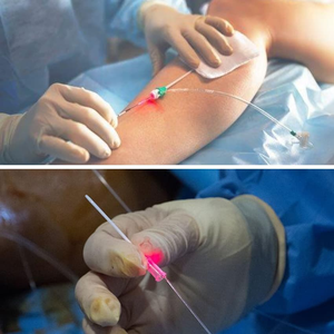 Penjualan Terbaik <span class=keywords><strong>Laser</strong></span> terapi fisik kelas <span class=keywords><strong>IV</strong></span> 980nm 1470nm photobiomodulation untuk penyembuhan luka dan nyeri pergelangan tangan - Product Image 2