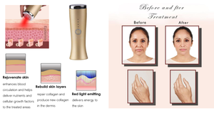 <span class=keywords><strong>Appareil</strong></span> de beauté rechargeable mini portable pour le visage, <span class=keywords><strong>anti</strong></span>-âge, lumière rouge, <span class=keywords><strong>anti</strong></span>-<span class=keywords><strong>rides</strong></span>, effet chaud à 43 degrés - Product Image 5