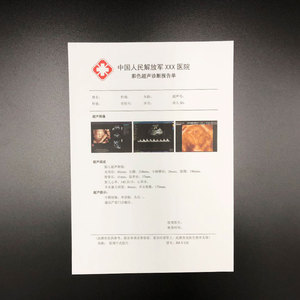 ポータブルLED医療用X線フィルムビューアーMSL1C一般フィルム、デジタルフィルム、乳房マンモグラフィフィルム - Product Image 3