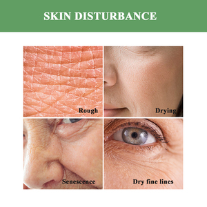 Tonique anti-<span class=keywords><strong>rides</strong></span> QBEKA pour une peau jeune, réduit les ridules et les <span class=keywords><strong>rides</strong></span>, éclaircit et hydrate le visage pour une peau éclatante - Product Image 4