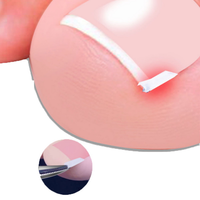 10 pièces outil de Correction des ongles incarnés traitement des ongles incarnés patch élastique autocollant redressage pince orthèse pédicure outil
