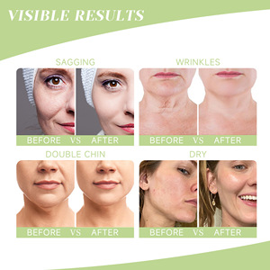 Face Moisturizer Relief Cream Anti Wrinkle Repair Firming Skin Oil Control Smooth Texture Brightening Nourishing Day Cream - Product Image 5