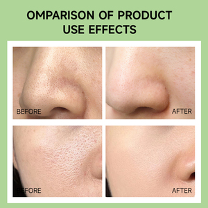 Esencia de Aloe Vera Vegana Orgánica a <span class=keywords><strong>Precio</strong></span> de Fábrica, Aclara las <span class=keywords><strong>Manchas</strong></span> Oscuras, Hidratante, Antiarrugas, Elimina los Puntos Negros, Mascarilla <span class=keywords><strong>Facial</strong></span> - Product Image 5