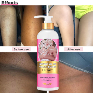 Prodotti di bellezza <span class=keywords><strong>e</strong></span> per <span class=keywords><strong>la</strong></span> cura della pelle crema idratante sbiancante AHA Niacinamide lozione per il corpo rimuovere le macchie scure sulla pelle - Product Image 1