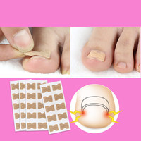 10 pièces haute élasticité sans colle incarné soin des pieds ongle correcteur Patch ongles guérison correcteur outil de traitement