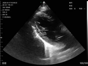 Hand Held <strong>Ultrasound</strong> Scanner Price <strong>Linear</strong> <strong>Array</strong> Wireless <strong>Probe</strong> USB Wifi <strong>Ultrasound</strong> Sales Portable <strong>Ultrasound</strong> Medical MD-4CPL - Product Image 3