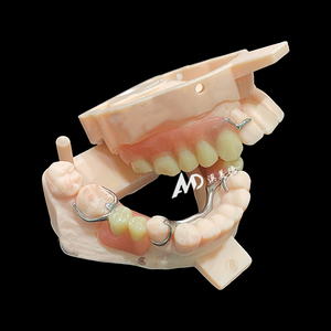 Protesi rimovibili personalizzate con struttura in metallo ripristinare la salute orale, facile da pulire, proteggere la pulizia orale - Product Image 5