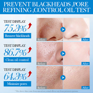 OEM SADOER Marque privée Boue de la mer Morte Nettoyage en profondeur Masque de boue pour le visage Aloe Skincare Masque facial pour le contrôle de l'huile et l'élimination des points noirs - Product Image 5