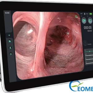 Choledochoscope vidéo flexible à usage unique, instrument chirurgical portable, endoscope vidéo humain et vétérinaire, série CH - Product Image 3